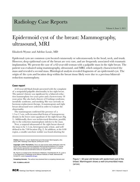 Pdf Epidermoid Cyst Of The Breast Mammography Ultrasound Mri