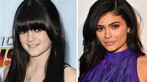 These Before And After Photos Of Kylie Jenner Will Ha