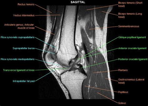 Knee Muscle Anatomy Mri Use The Mouse To Scroll Or The Arrows Mr