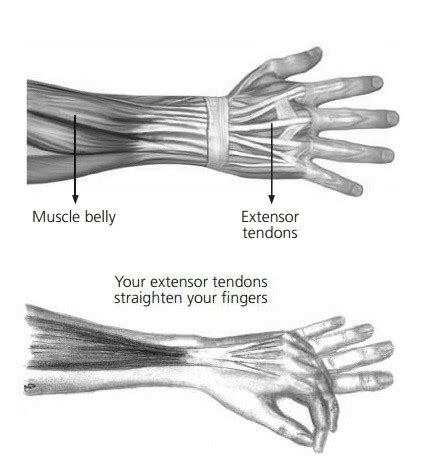 Hand Therapy Extensor Tendon Finger Repair Merritt North Tees And Hartlepool Nhs