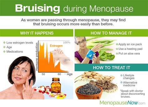 Bruising During Menopause Menopause Now