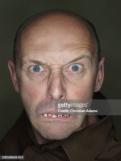 Ugly Bald People Photos And Premium High Res Pictures Getty Images