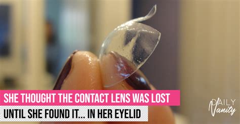 Woman Found A Contact Lens That Was Missing For 28 Years In Her Eyelid Daily Vanity Singapore