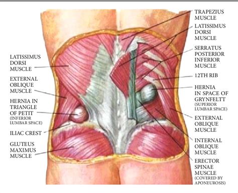 Laparoscopic Repair Of Lumbar Hernia A Case Report And Mini Review Semantic Scholar