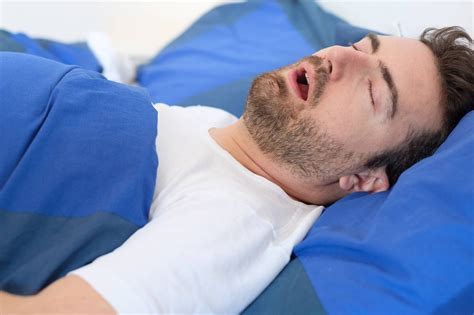 Sleep Apnea Treatment Turlock Ca Stop Snoring Sleep Apnea Dentist Modesto