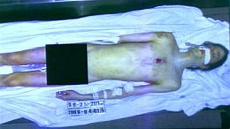 Difunden Foto De La Autopsia A Michael Jackson