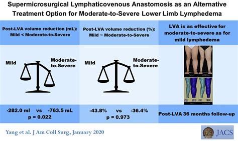 Supermicrosurgical Lymphaticovenous Anastomosis As Alternative