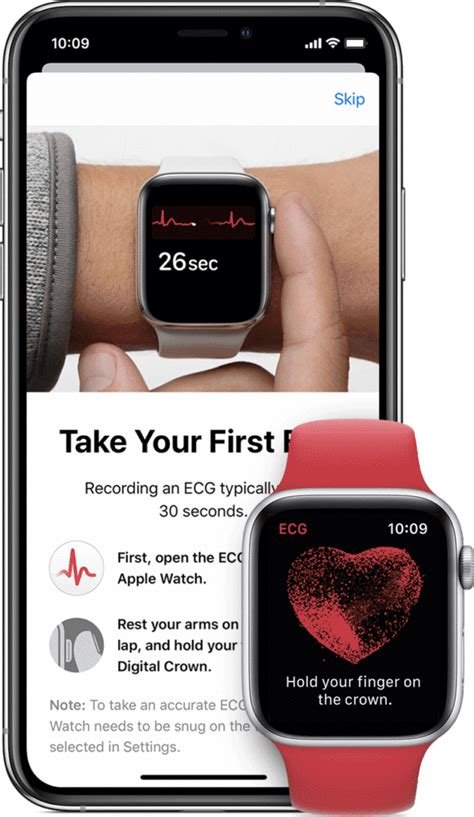 Submissions must be about apple watch or apple watch related accessories/topics. Apple Watch ECG App | A Cardiologists View | Dr. Chauncey ...