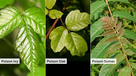 How To Treat A Poison Oak Poison Ivy Or Poison Sumac