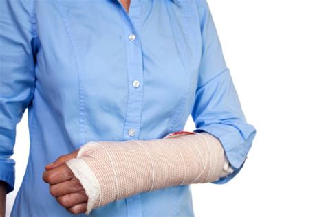 Senior Woman Wrapped Wrist And Arm After Surgery Cast Broken Stok