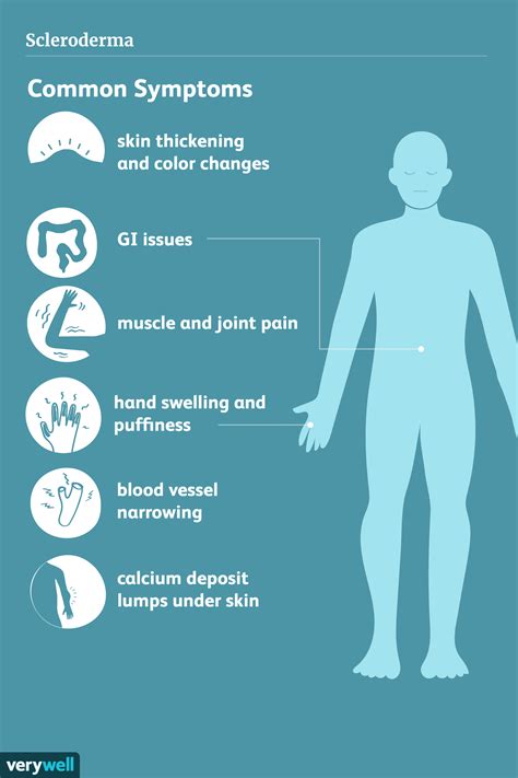 Symptoms Of Scleroderma 2023