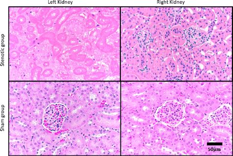 Representative Images Of Histology Of Kidneys From Stenosed Group Top