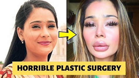 Top 10 Bollywood And Tv Actress Plastic Surgery Before And After Photos Youtube