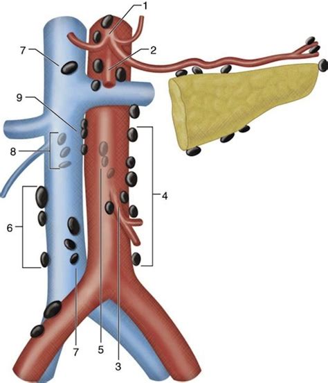 Illustration Of The Retroperitoneum Depicting The Retroperitoneal Lymph