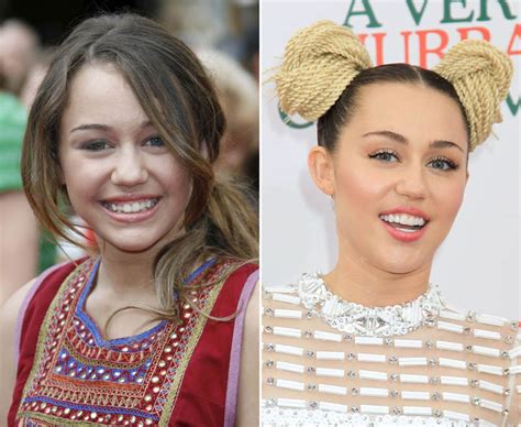Disney Miley Cyrus Teeth Vs Modern Day Miley Teeth