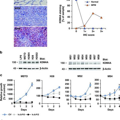 Kdm4a Expression In Mpm Is Essential For Cell Growth A Representative