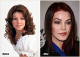 Priscilla Presley Plastic Surgery Disaster That Should Not Be Done ...