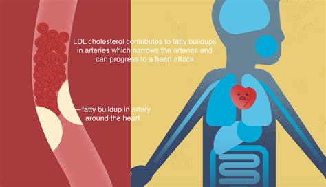 What is LDL Cholesterol? - Piper Biosciences