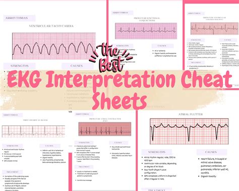 The Best Ekg Interpretation And Heart Arrhythmias Cheat Sheet Cheat