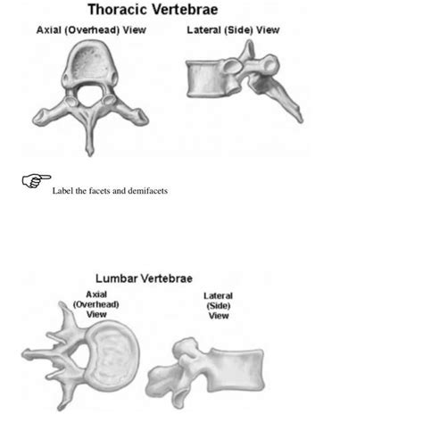 Solved Thoracic Vertebrae Axial Overhead View Lateral Chegg Com