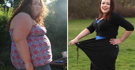 Obese Mum Sheds Stone After Weight Almost Suffocates Her Daily Star