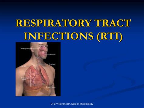 Ppt Respiratory Tract Infections Rti Powerpoint Presentation Free