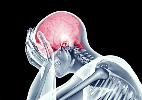 Recovering From A Traumatic Brain Injury Blog Dolman Law