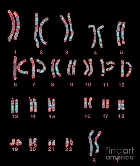 Enhanced Lm Of Normal Female Chromosomes Photograph By Dept Of Clinical Cytogenetics
