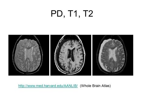 Contrast In Mri Pd T1 And T2 Ppt Video Online Download