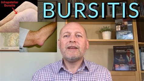 Bursitis In A Nutshell Get It Better Quickly Youtube