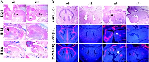 Sox9 Is Required For Determination Of The Chondrogenic Cell Lineage In