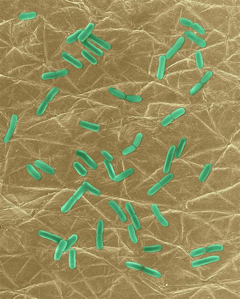 E Coli On Human Skin Surface Photograph By Dennis Kunkel Microscopy