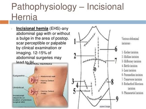 Incisional Hernia