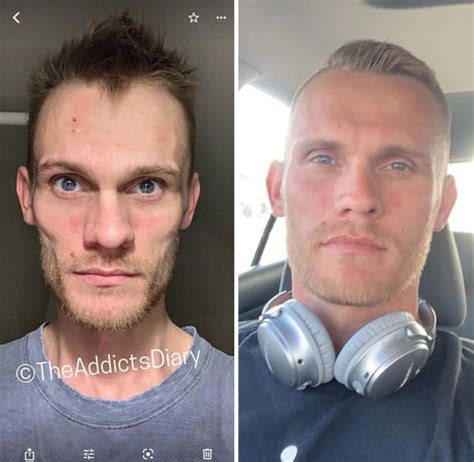 How Drug Addiction Looks Before And After Pics Izispicy Com