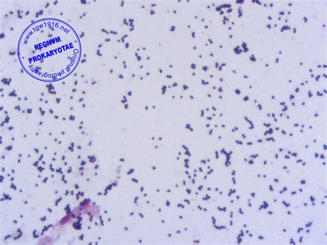 Streptococcus Faecalis Gram Stain