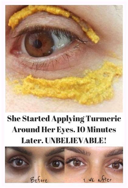 She Started Applying Turmeric Around Her Eyes Minutes Later
