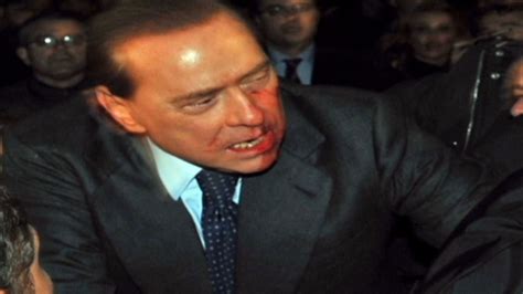 Broken Teeth Nose Cap Year Of Woes For Italy S Prime Minister