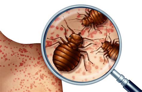 What To Do If You Suspect Bed Bugs Have Infested Your Home Tri