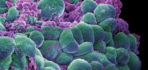 Cancer mutations, cell by cell | eLife Science Digests | eLife
