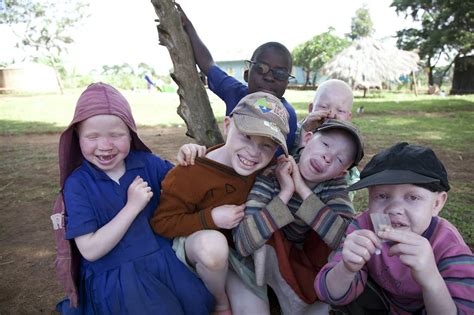 Alinc Inclusion For Children With Albinism Liliane Fonds
