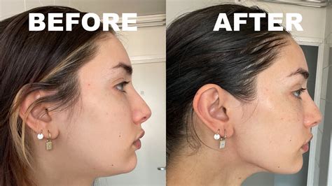 Trying A Gua Sha Routine For A Month Before And After Pics Youtube