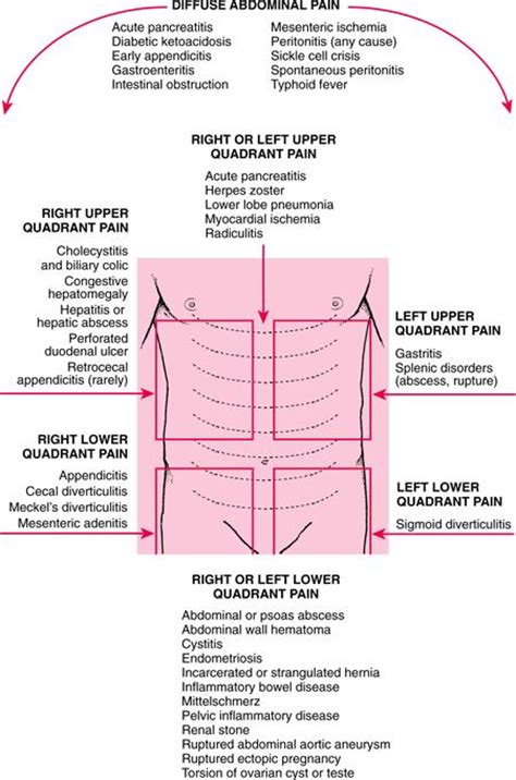 Chronic Abdominal Pain Upper Right Quadrantnot