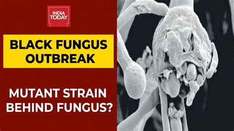 Black Fungus Outbreak Karnataka Doctors Suggest Mutant Strain Behind