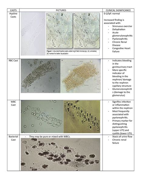 Casts Casts Pictures Clinical Significance Hyaline Casts Lpf