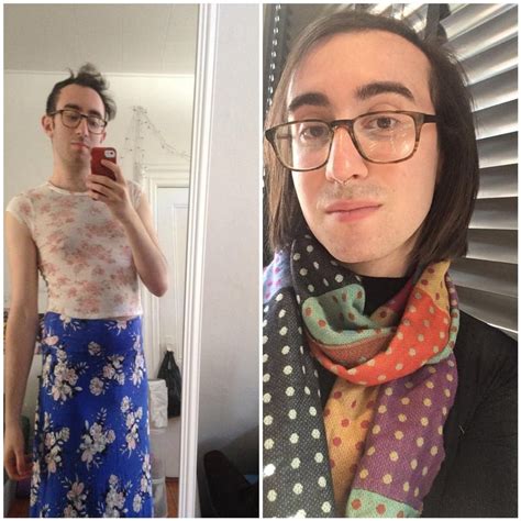 22 Non Binary Trans Woman 7 Months Hormones 3 Laser Sessions Post