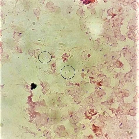 Gram Stain Of Blood Culture Showing Gram Negative Rods Of Download