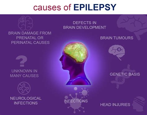Epilepsy is a common disorder that causes seizures. Suffering Epilepsy | Help Friends, Family and Colleague ...