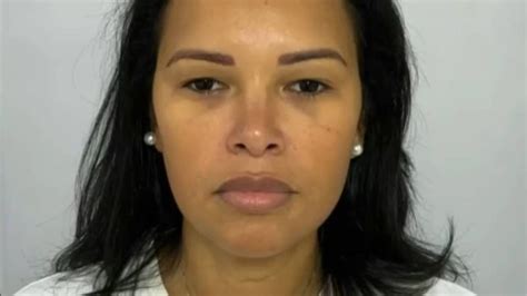 Ex Bbb Ariadna Arantes Aposta Em Harmonização Facial E Mostra Antes E Depois Surpreendente