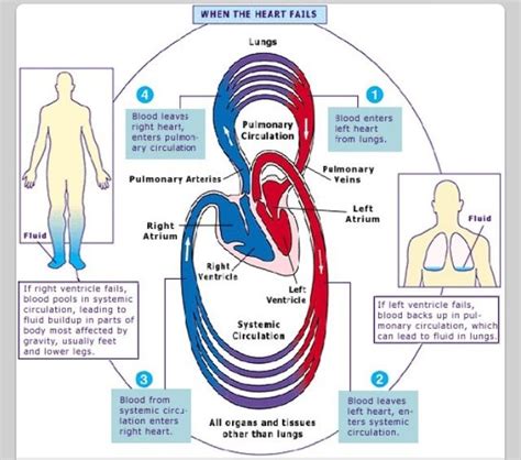 What Happens In Heart Failure Nursing School Studying Nursing Career