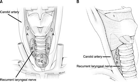 Pre Tracheal Lymph Node Doctorvisit